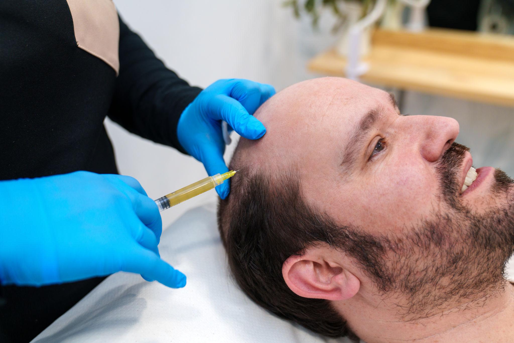 PRP Platelet Therapy Hair Loss Pembroke Pines Vita Health Dr Pakula PRP Platelet Therapy Hair Loss Pembroke Pines Vita Health Dr Pakula
